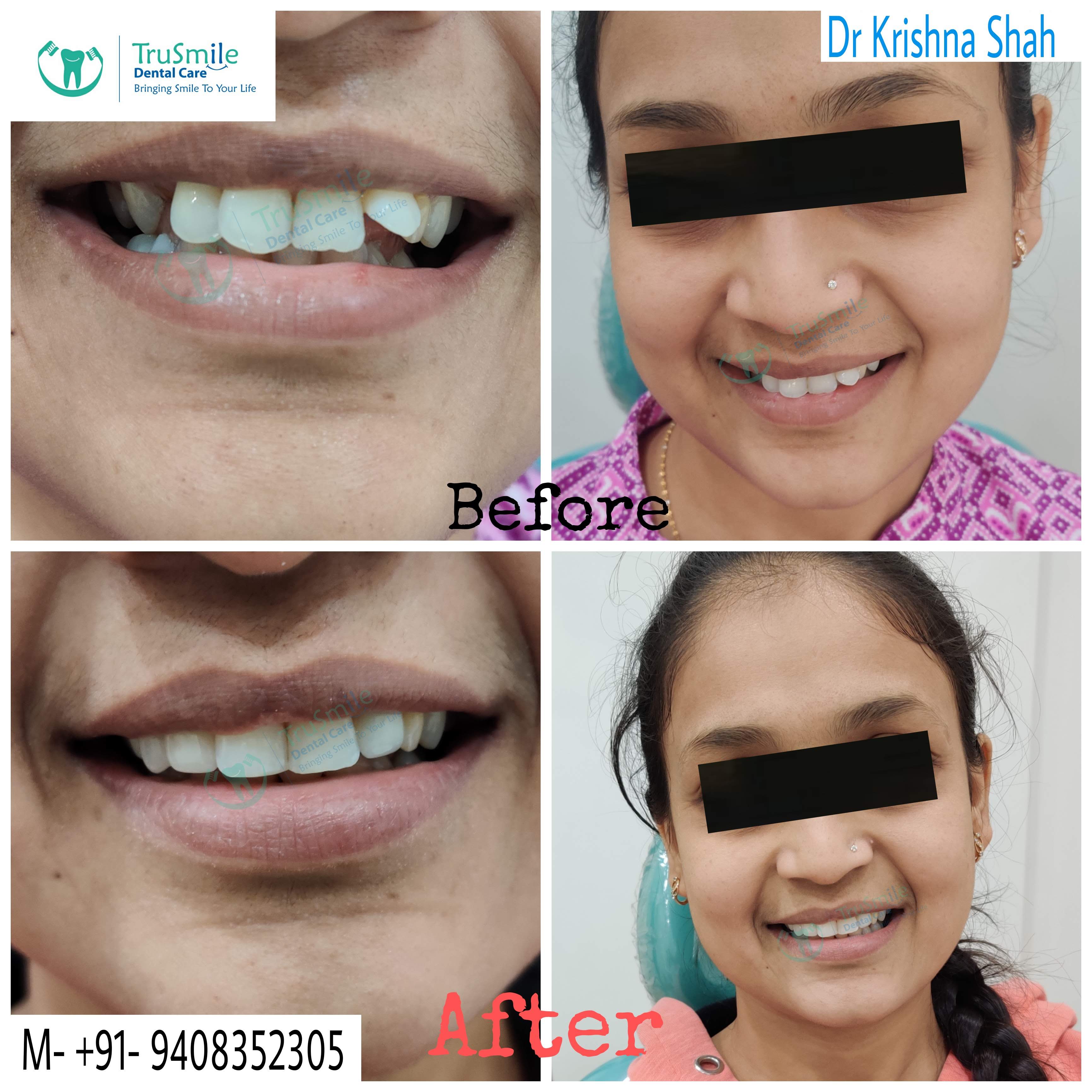Smile Design 10